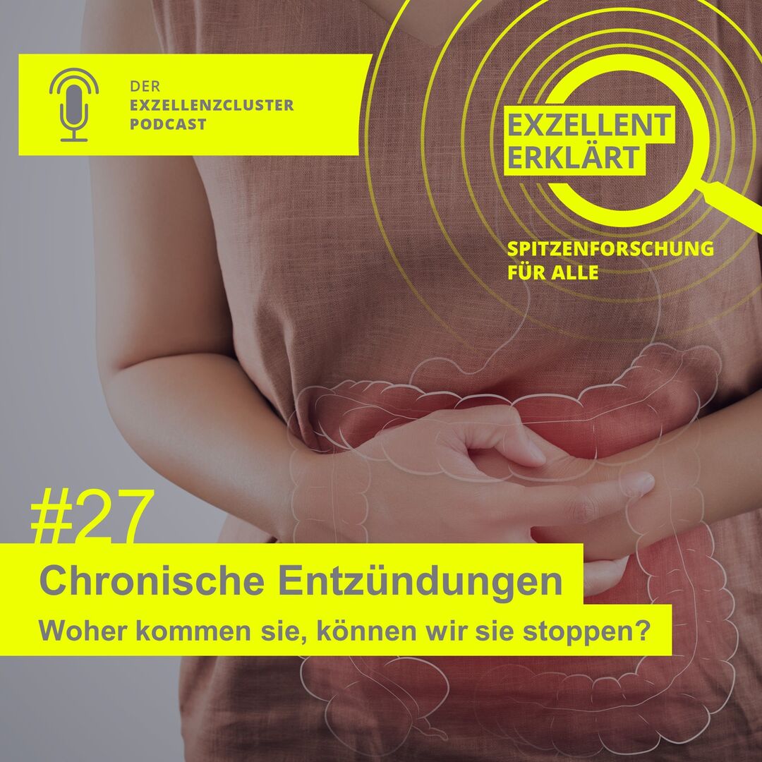 Exzellenzt Erklärt
