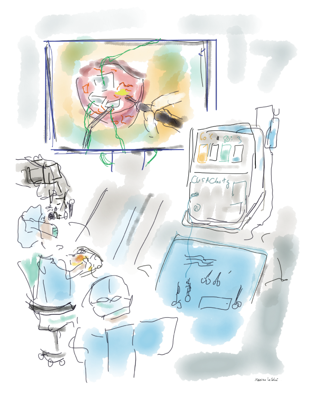 Vanessa at work on the operating table, with her instruments plunged into her brain, seated at the binocular microscope. The giant screen shows what she is seeing, allowing the head surgeon to supervise her. Copyright: Drawing by Maxime Le Calvé, digital, 2019
